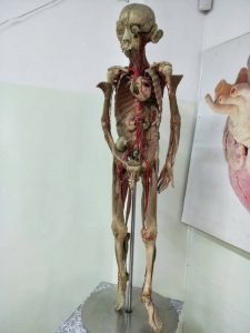 IMG-20171210-WA0024